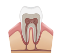 root-canals-qa4v427dxbiku6djtfg34yr6mxvi8fz4vgnwstmogc root canals