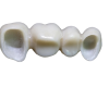 zirkonyum_porselen_1-qa4tr6liaougqw0awwt07dfmcs3n443cpty4z9cq3k Zirconium Ceramic